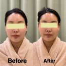 오미 | 임산부 부종부터 탄력까지! 부산 만덕 산전/산후관리 전문 만덕피부관리<브이오미 에스테틱> 솔직후기