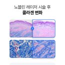 노블린