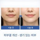 더쥬브