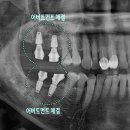 다대1동-4 네이버블로그