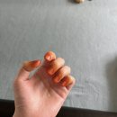 청담한빛안과의원 네이버블로그