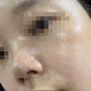 소정피부관리샵 | 옥산 [샵피부하다] 수분 기본관리 이용후기