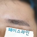 페이스라인(FACELINE) 이미지