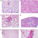 양식 네날가지 Eleutheronema tetradactylum의 Edwardsiella piscicida 이미지