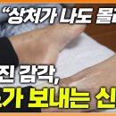 한번 손상되면 회복이 어렵고 완치 약도 없는 말초신경병증 어떤 증상이 있을 때 의심해 봐야 할까? 이미지