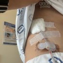 내가1 | 2. 서울성모병원 폐암수술 후기. 내가 폐암1기 라니! 최종 후기