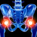 수원고려본정형외과의원 이미지