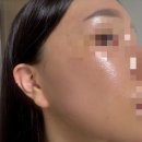 제일신진타운 | [공지] 부산 하단 피부관리 [글로우에스테틱] 오투덤산소테라피 후기