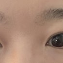 JK서울안과의원 이미지