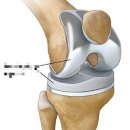 슈트짐(SUIT GYM) 이미지