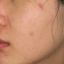 비케이 인터내셔널 이미지