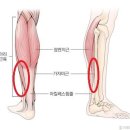 안암정형외과의원 네이버블로그