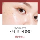 김국민의원 | 기미 레이저 종류 잘 알아보고 받아야