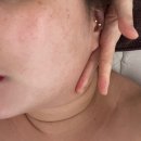 [경기 고양] 정발산역피부관리 정발산역피부과 일산피부관리 스킨플렉스 다녀온 후기