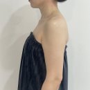 청담미 | 현풍마사지 청담미가 거북목 관리 후기