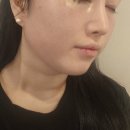 조은생활 | 진해웨딩관리 조은얼굴에스테틱 피부관리샵 솔직 후기