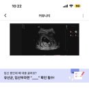 최성은산부인과 네이버블로그