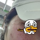루비PC | [백수일기 1일차] 압구정 루나의원 루비레이져, 가성비 노트북(레노버)을 찾아라