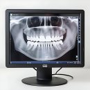 구용치과의원 | 요즘 치아 상태 왜 이래? 찐솔직 내돈내산 후기 들고 왔어요!