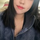 [보조개 수술 내돈내산 후기(1)] - 1~5일차 / 사진 많음 주의!!!