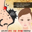 모범약초