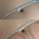 레드핏 | 대전 갈마동 다이어트 에이아이앤비뷰티에서 복부 레드핏관리 후기