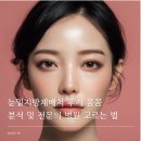 라이트성형외과의원 | 강남 신사역 성형외과 눈밑지방재배치 후기 꼼꼼 분석 및 전문의 병원 고르는 법