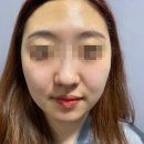 청초에스테틱