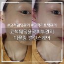 이끌림케어 | 고척웨딩윤곽피부관리 이끌림 밸런스케어 후기｜얼굴경락+올리지오 500샷 턱라인 관리 솔직 리뷰