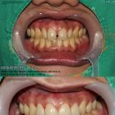 디자인치과기공소 이미지