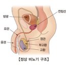 의학과한방(동영상):양성 전립선 비대증 (Benign prostatic hyperplasia) 이미지