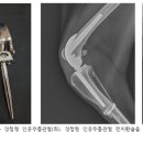 (주)비트러스트메디텍 네이버블로그