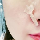 다시봄날의원 | 다시봄날의원 점빼기 파주피부과내돈내산