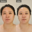 황금비에스테틱 | 개금피부관리 황금비에스테틱 작은얼굴관리 후기