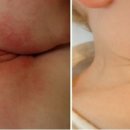 이엠한의원 이미지