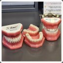 조인치과의원 | 풍산동치과 치아교정 통증 걱정된다면