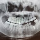 서울김치과의원 이미지