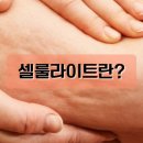 고은라인