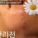 에이치닝