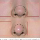 봄봄피부과의원 네이버블로그