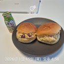 Y마트연제플러스점 | [임신기록] 임신 10~11주차 기록 및 11주 목투명대 검사와 니프티 검사 (제노맘플러스)