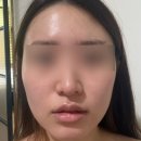 인천논현피부관리 에스테틱 고운 얼굴 두피 케어 후기