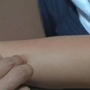 고려일침한의원 | 림프순환, 붓기 빼는 혈자리 지압, 마사지? 8년차 한의사가 알려드립니다