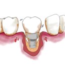 엔젤치과의원 이미지