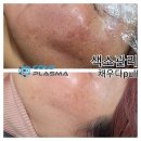 채우다pull 이미지
