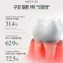 비영헬스케어 | 특별 할인 행사] 잇몸 붓기 잡는 센텔라 치약! 구취·치은염 고민 해결! 보타랩 비영풀 치약 진짜 효과는?