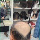 김호증모가발다온헤어
