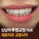 강남새로치과의원 | 치아교정 투명교정 인비절라인·나노라이너｜강남 새로치과 재교정 후기