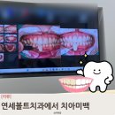 연세어린이집 | 연세볼트치과 오픈이벤트로 치아미백 받고 왔어요!