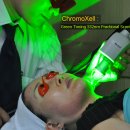 ChromoXell : Green Toning 532nm Fractional ScanLaser 이미지